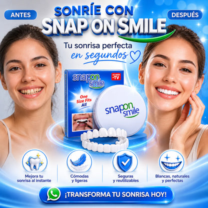 Carillas dentales - Snap on Smile